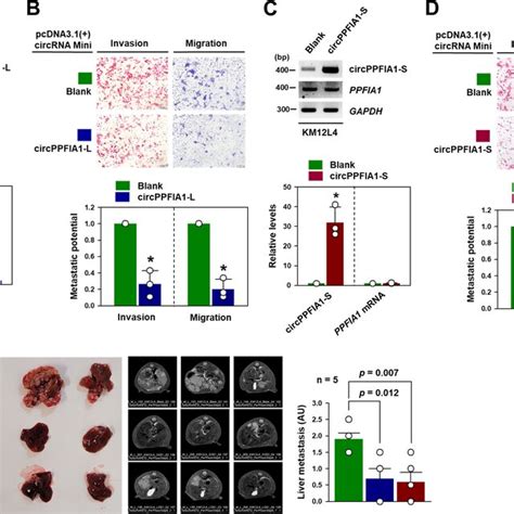 Overexpression Of Circppfia1s Attenuates Metastatic Potential Of Km12l4