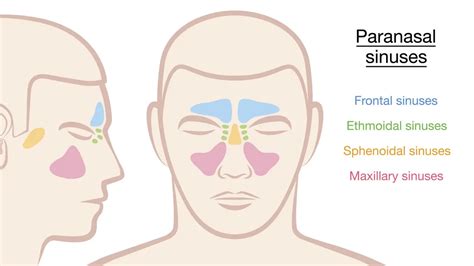 Mengenal Penyakit Sinusitis Penyebab Dan Cara Penanganannya Health