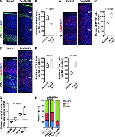 Pard3 Deletion Leads To Systematic Alterations In Neuronal Composition