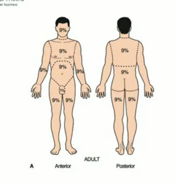 EM Toxicology Environmental Hazards Flashcards Quizlet