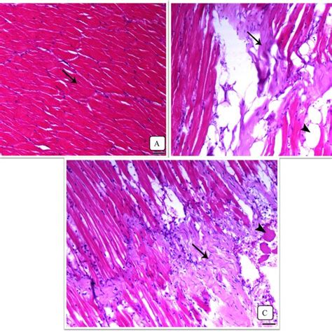 Skeletal Muscle Section Of Fish H Postinfection A Control Fish