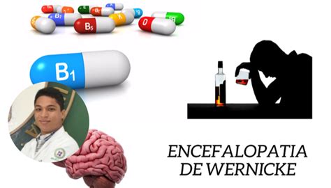 Encefalopatía de Wernicke DiarioSalud do