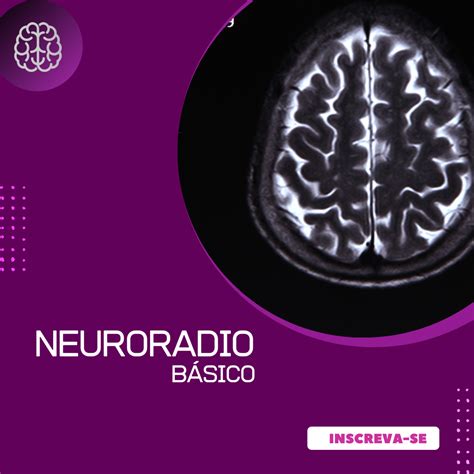 NeuroRadio básico Neurointensivo Cursos Hotmart