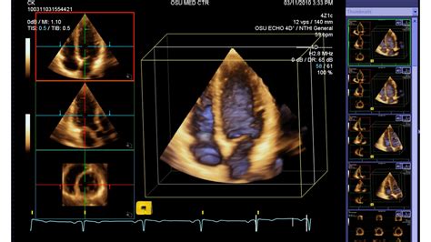 Ase 3d Echocardiography Library