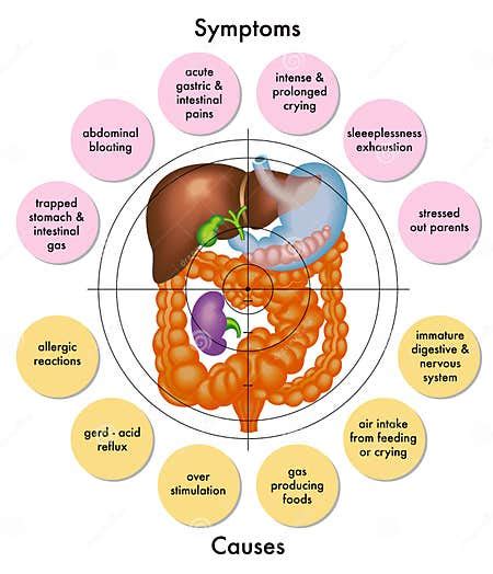 Colic stock vector. Illustration of colic, bladder, biliary - 23570739