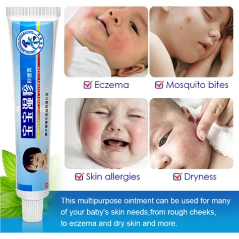 Baby Butt Rash Cream Krim Ubat Gatal Bayi 20g Penyakit Kulit And Nyamuk