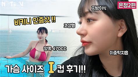 가슴 I컵 후기는 처음이지💖 비키니 인증샷 추가 매부리코 화살코 교정수술이중턱지흡지방이식멘토가슴수술470cc후기