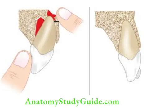 Luxation Injuries Treatment Notes - Anatomy Study Guide