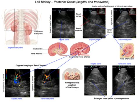 Renal Ultrasound, Lecture 15, Lecture 16, Lecture 17, Lecture 18 ...