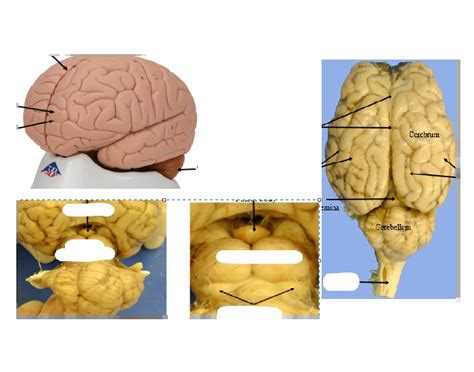 Whole Brain/Dorsal View Quiz