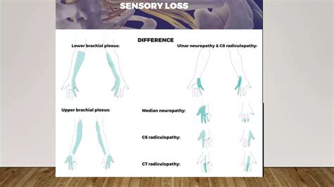 Thoracic Outlet Syndrome TOS PPT