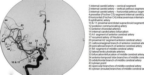 Neuroradiology Cases Normal Brain Angiogram Dsa