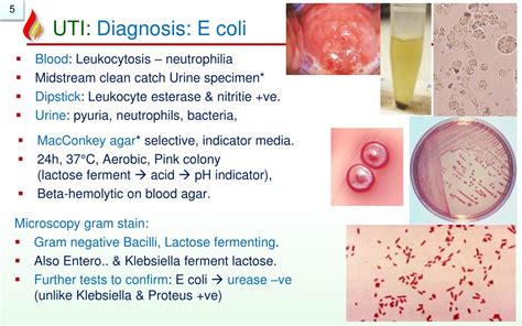 Ppt Pathology Of Urinary Tract Infectionws Powerpoint Presentation Free Download Id8201956