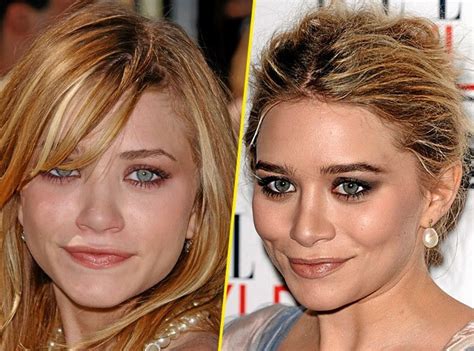 Les Stars avant après leurs Transformations Mary Kate Olsen