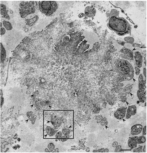 Representative electron microscopy photograph of Schwann cells near a ...