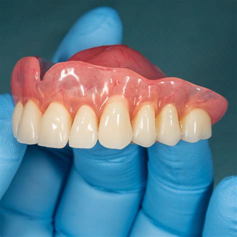 Full Dentures | Complete Dentures | Morley Denture Pros