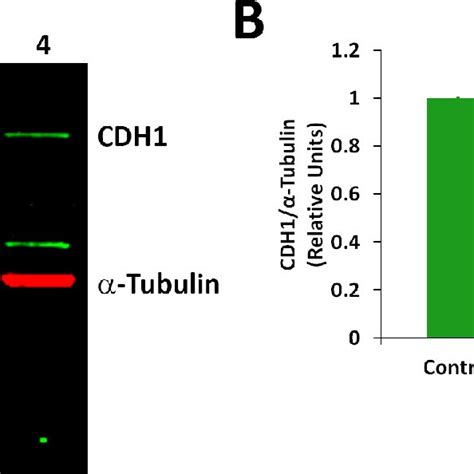 Proinflammatory Cytokines Decreased The Expression Of The Cdh Protein