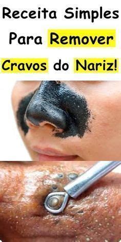 Técnica Caseira Para Remover Cravos do Nariz em 2 Minutos Tirando