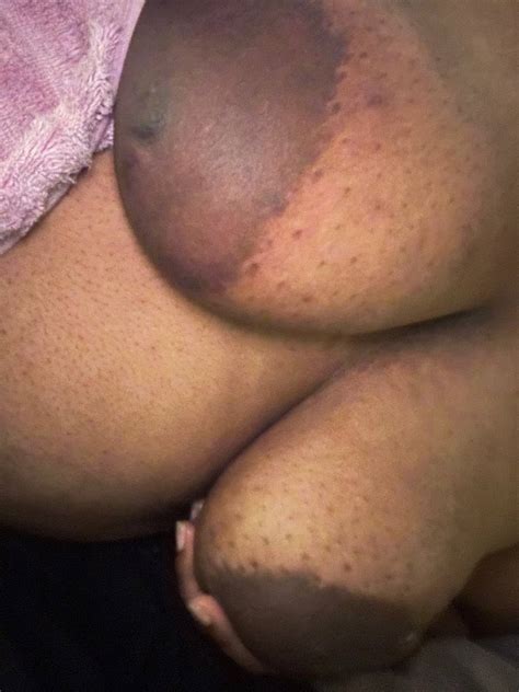 Exposed Big Black Ebony Bbw Tits ShesFreaky