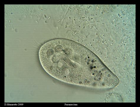 Paramecium X Labeled