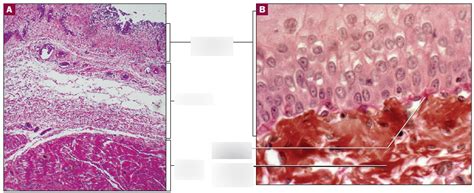 urinary bladder bladder wall   close   transitional