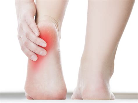 Top Tips To Manage Heel Pain | Foot Centre Group