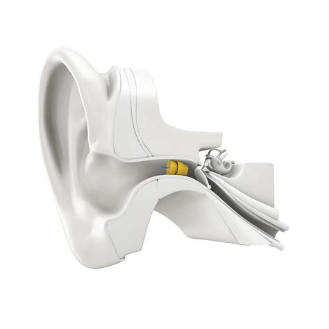 Phonak Lyric Invisible Hearing Aid - 1 Year Subscription (Binaural ...