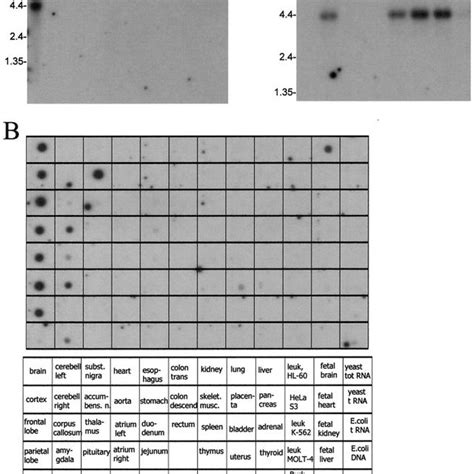 Northern And Dot Blot Analyses Of Mrna Distribution Of Mch R2 In Human