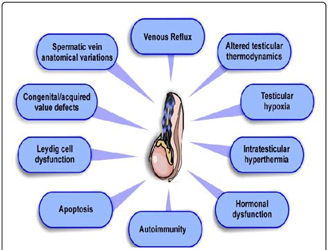 Varicocele Diagram