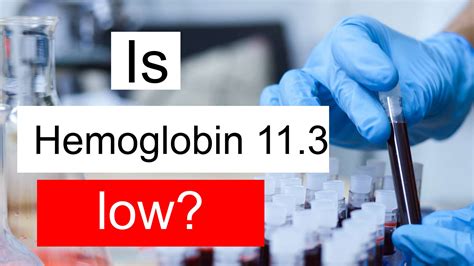 Is Hemoglobin 11.3 low, normal or dangerous? What does Hemoglobin level 11.3 mean?