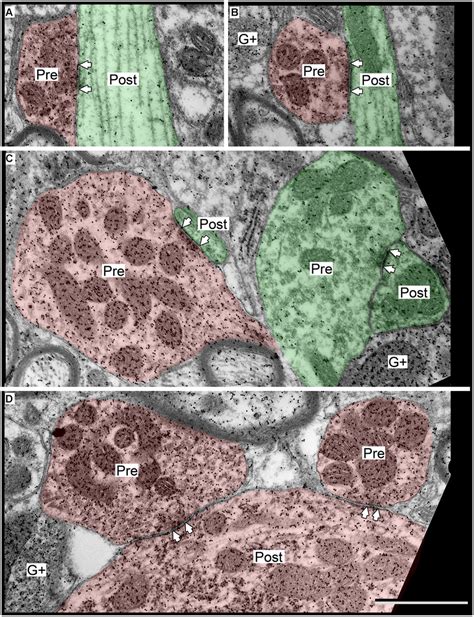 Electron Micrographs Showing Examples Of Gabaergic Synapses In The Icc