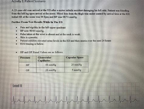 how to calculate hr on ecg strip