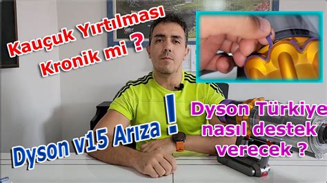 Dyson v15 Kauçuk Sünger Yırtılma Sorunu Kronik mi YouTube