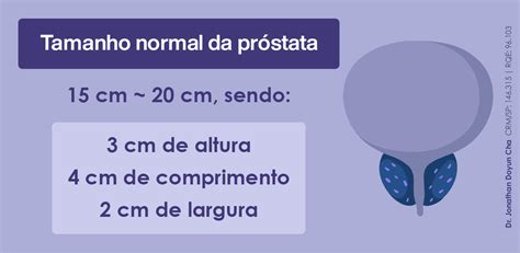 Cirurgia laser HoLEP para hiperplasia benigna da próstata