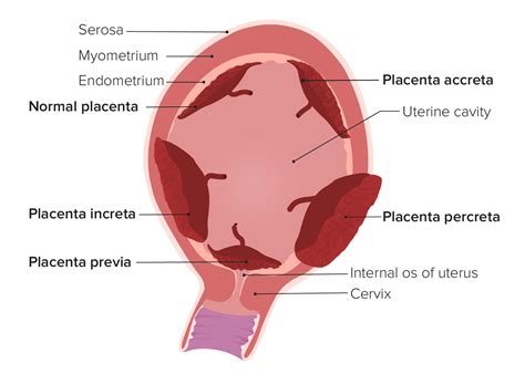 Imagenología Obstétrica Concise Medical Knowledge