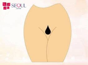 mẫu triệt lông bikini tạo hình nữ giới đẹp ấn tượng