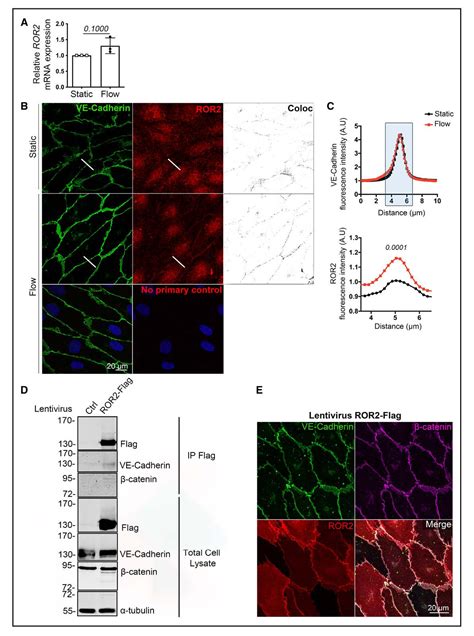 Figure 5 From ROR2 PCP A New Pathway Controlling Endothelial Cell