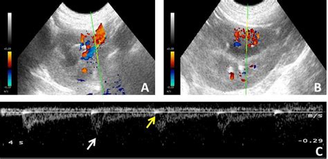 Ultrassonografia Doppler Colorido E Pulsado Do Rim Esquerdo De C O