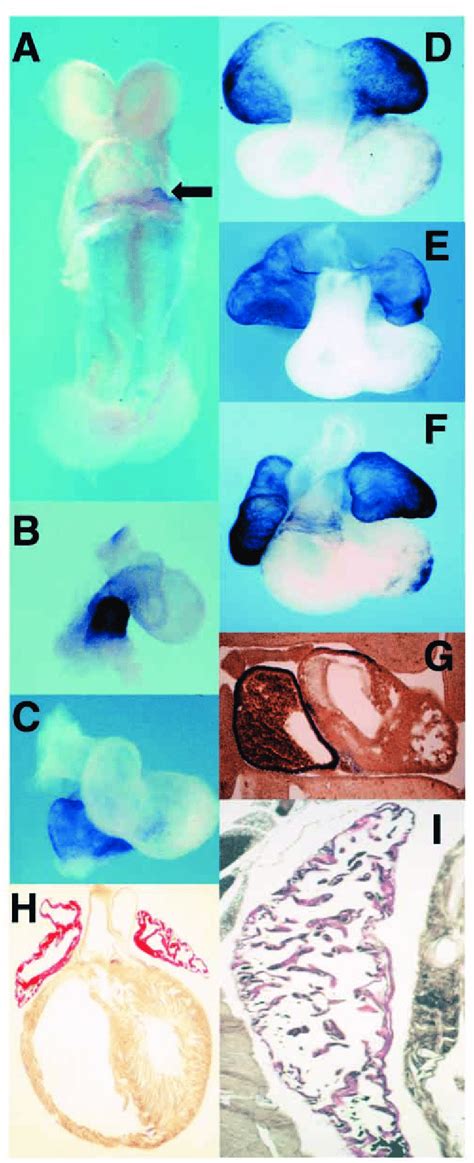 Time Course Of Smyhc Expression During Cardiac Development In The