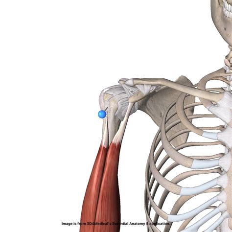 Biceps Tendinitis