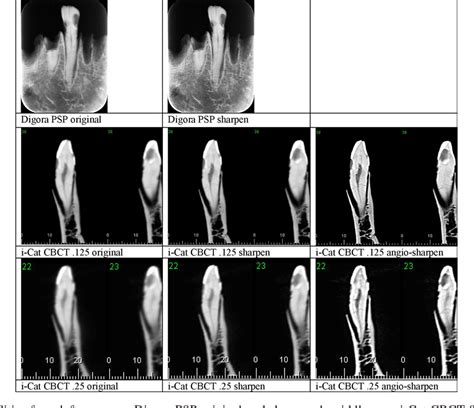 Figure From Variable Resolution Cone Beam Computerized Tomography