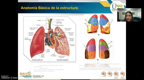 Fase2 Caso Clínico Neumotórax Espontáneo a Tensión YouTube