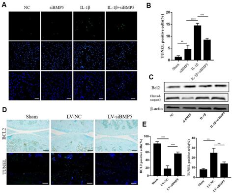 Bmp5 Silencing Protects Against Chondrocyte Apoptosis In Both In Vivo