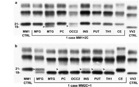 Western Blot Profiles Of Prp Sc F Antibody From Different Brain