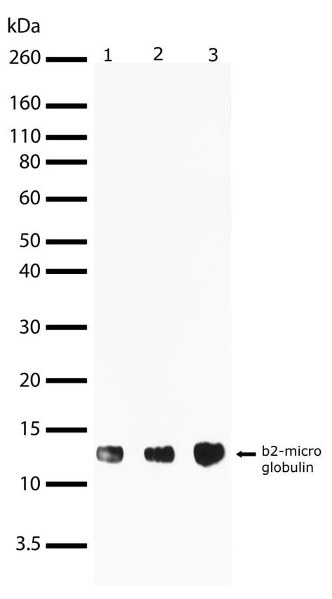 Beta 2 Microglobulin Rabbit Anti Human Invitrogen™ 100 μg