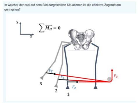 Biomechanik Flashcards Quizlet