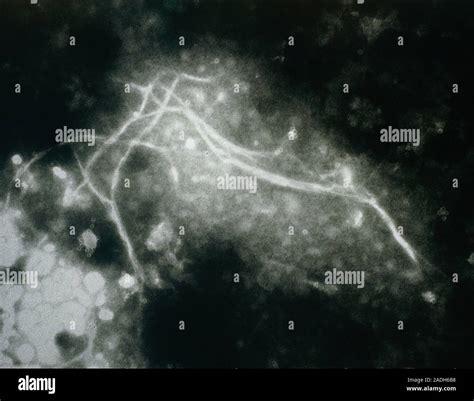 Trasmission Electron Micrograph Of Negatively Stained Fibrils