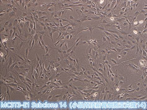 Mc3t3 E1 Subclone 14细胞 小鼠颅顶前骨细胞亚克隆14 Str鉴定正确价格品牌益普生物 丁香通官网