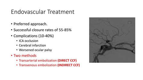 Carotid Cavernous Fistulas Ppt