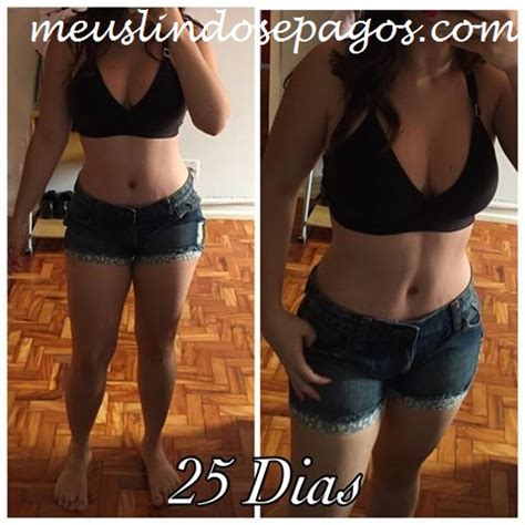 Meus Lindos E Pagos Arquivos Abdominoplastia Lipoescultura